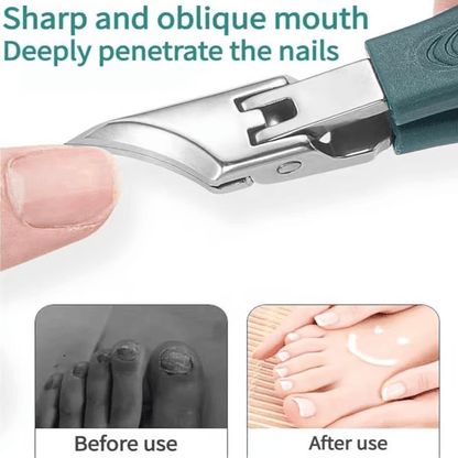 🔥Last Day Sale - Eagle Beak Angled Nail Clippers 3-Piece Set
