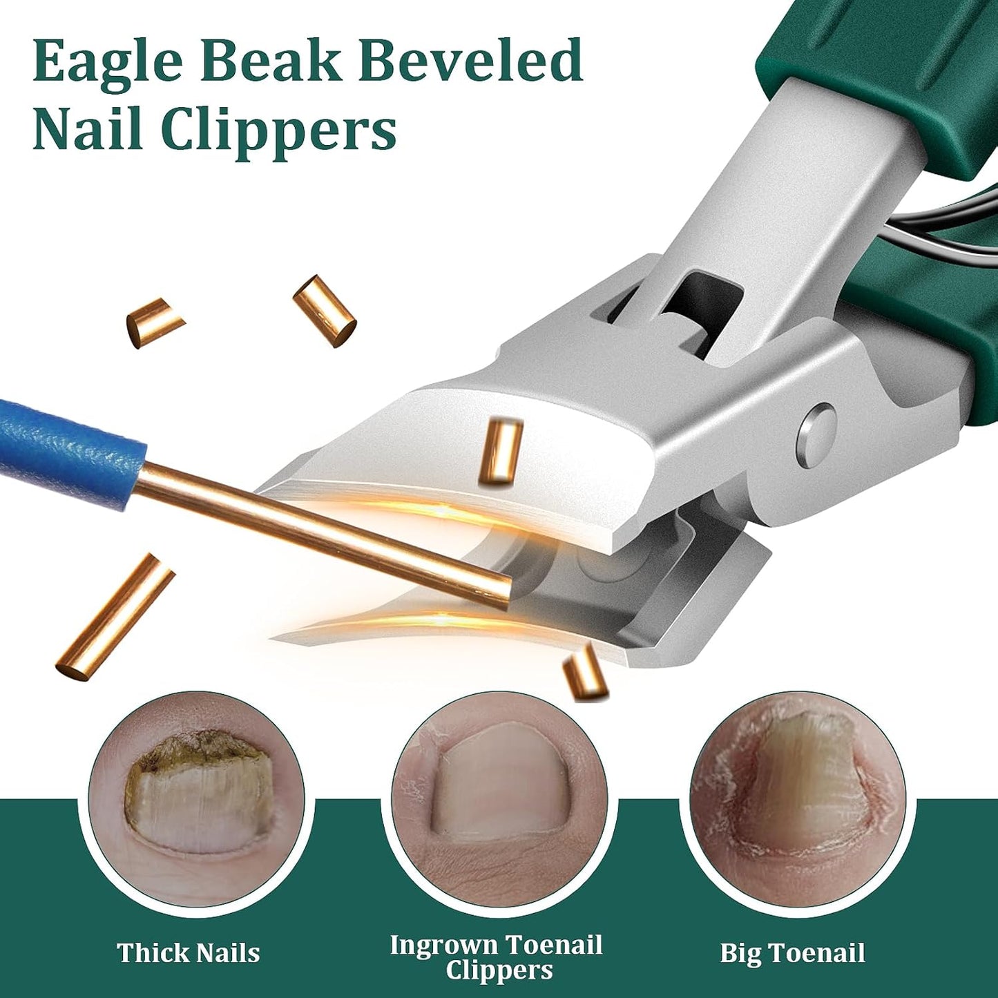 🔥Limited Time 50% Off✨ 3 PCS Eagle-Beak Ingrown Toenail Clipper