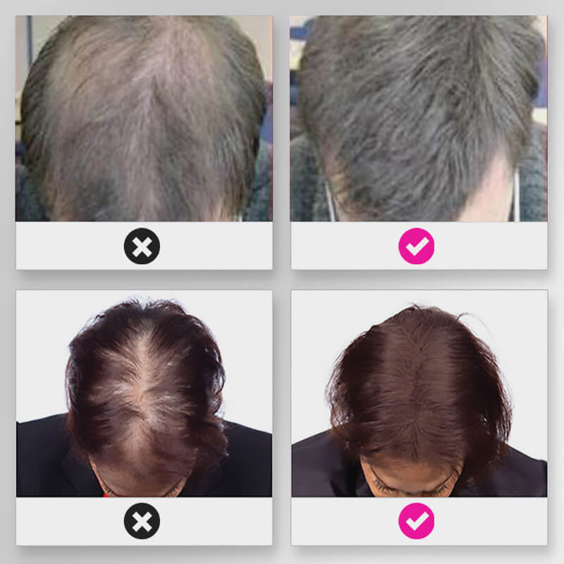 🔥BUY 1 GET 1 FREE💝Hair Thickening Hair Building Fiber Powder