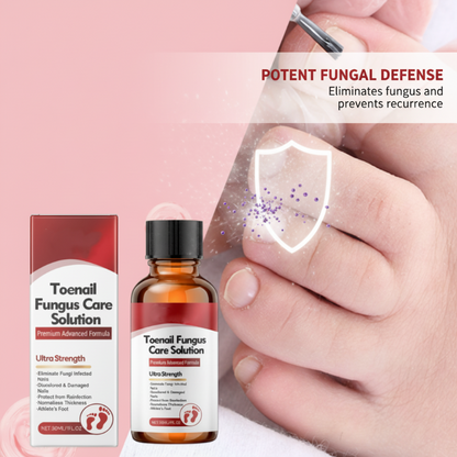 🔥Hot Sale-50%OFF!🔥🖤See Real Results Faster🖤2 bottles Nail Repair Essence for Damaged Nails💅🏻