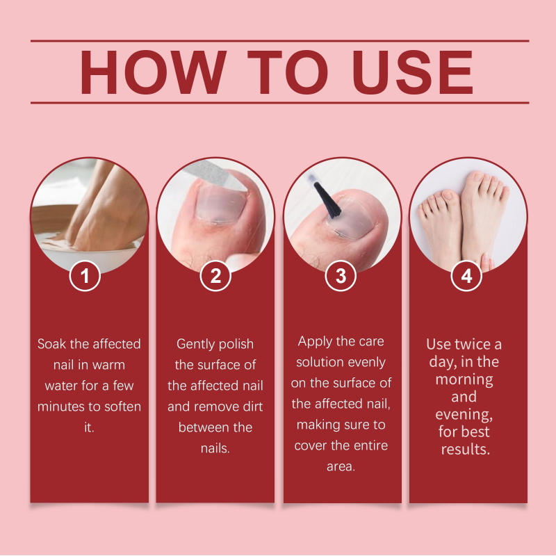 🔥Hot Sale-50%OFF!🔥🖤See Real Results Faster🖤2 bottles Nail Repair Essence for Damaged Nails💅🏻