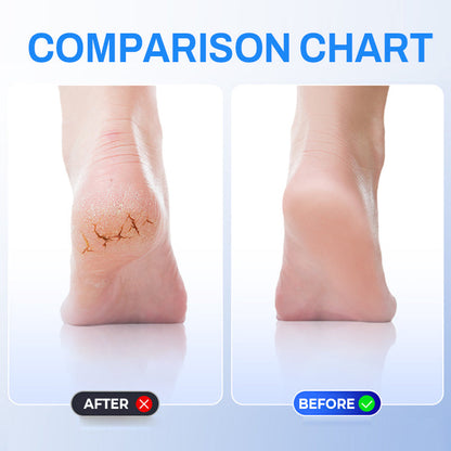 Rechargeable Electric Foot Grinder