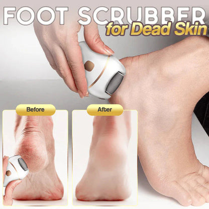 ⏰Rechargeable Electric Foot Exfoliating Scrubber