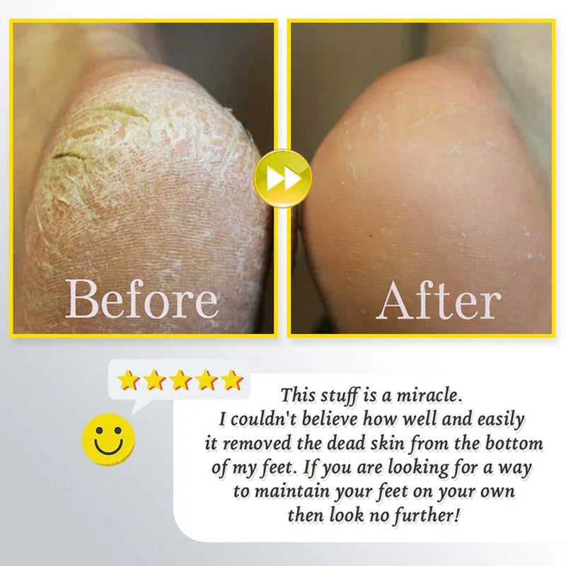 ⏰Rechargeable Electric Foot Exfoliating Scrubber