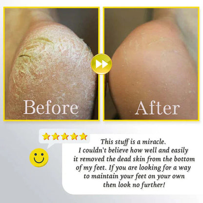 ⏰Rechargeable Electric Foot Exfoliating Scrubber