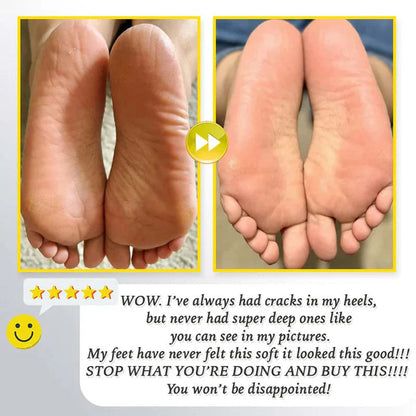 ⏰Rechargeable Electric Foot Exfoliating Scrubber